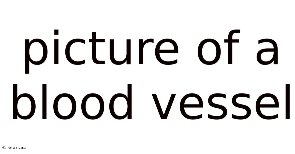 Picture Of A Blood Vessel