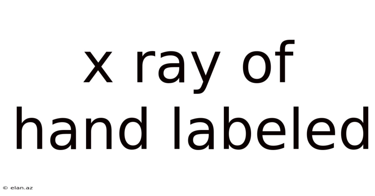 X Ray Of Hand Labeled